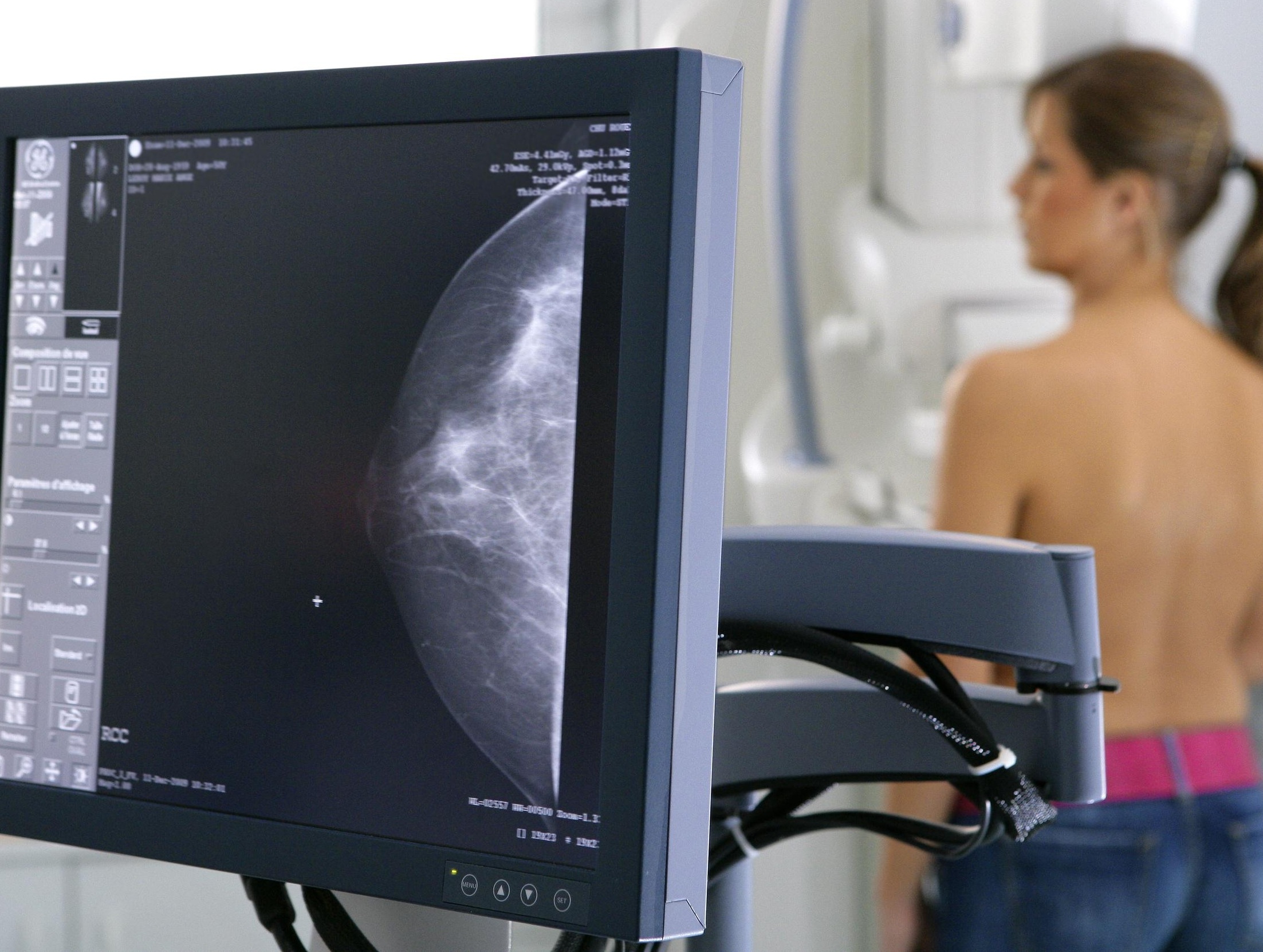 Скрининг рака молочной железы с помощью искусственного интеллекта