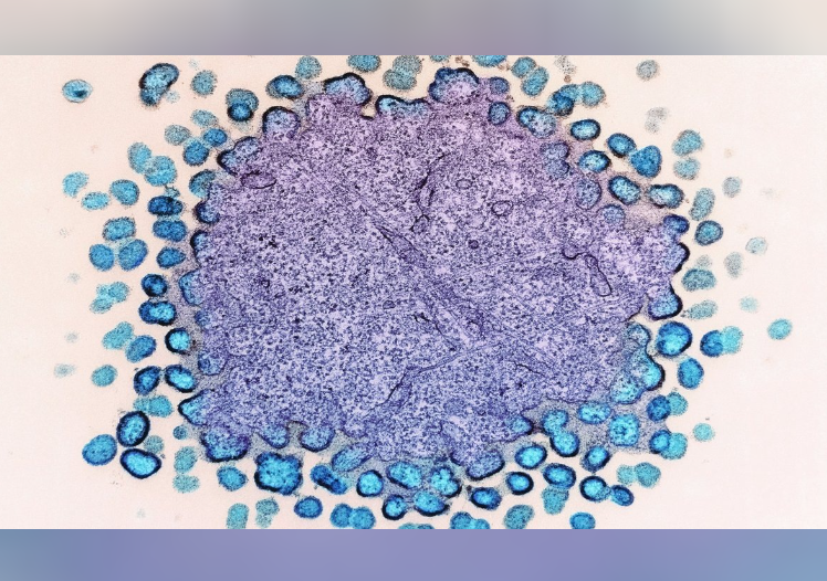 Открыт эффективный способ уничтожения раковых клеток