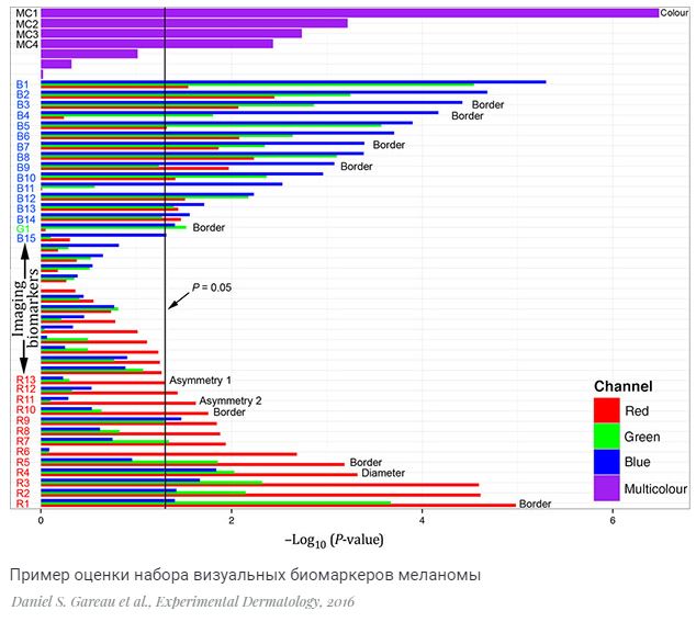 Диагностика меланомы 2.JPG